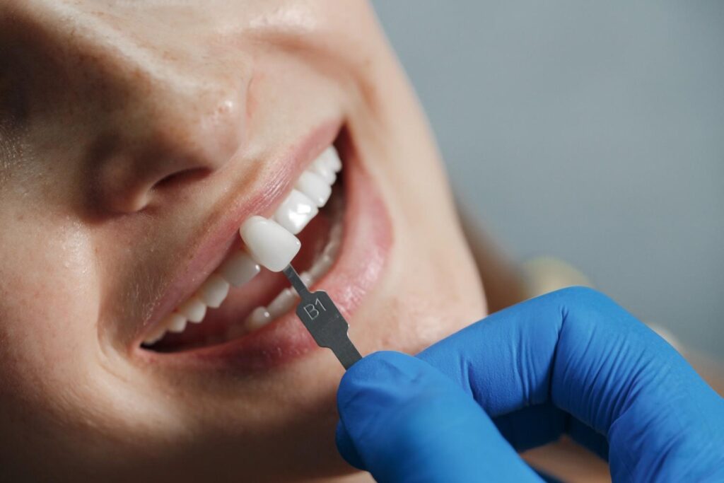 tooth Recontening